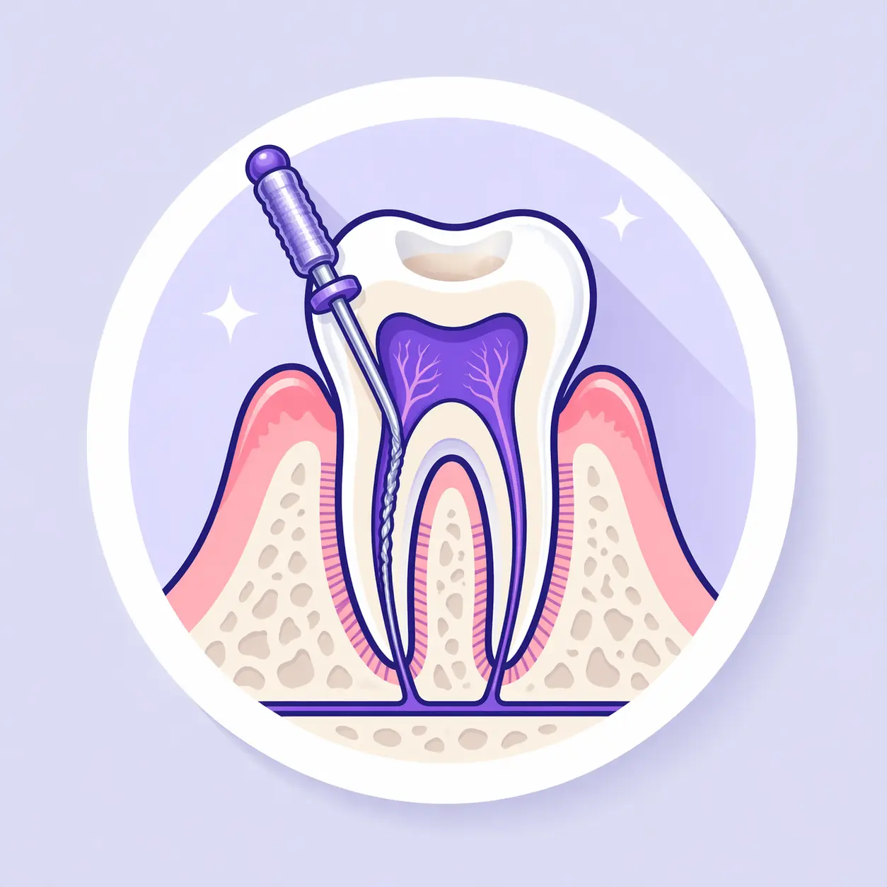 Illustrazione raffigurante il concetto di endodonzia