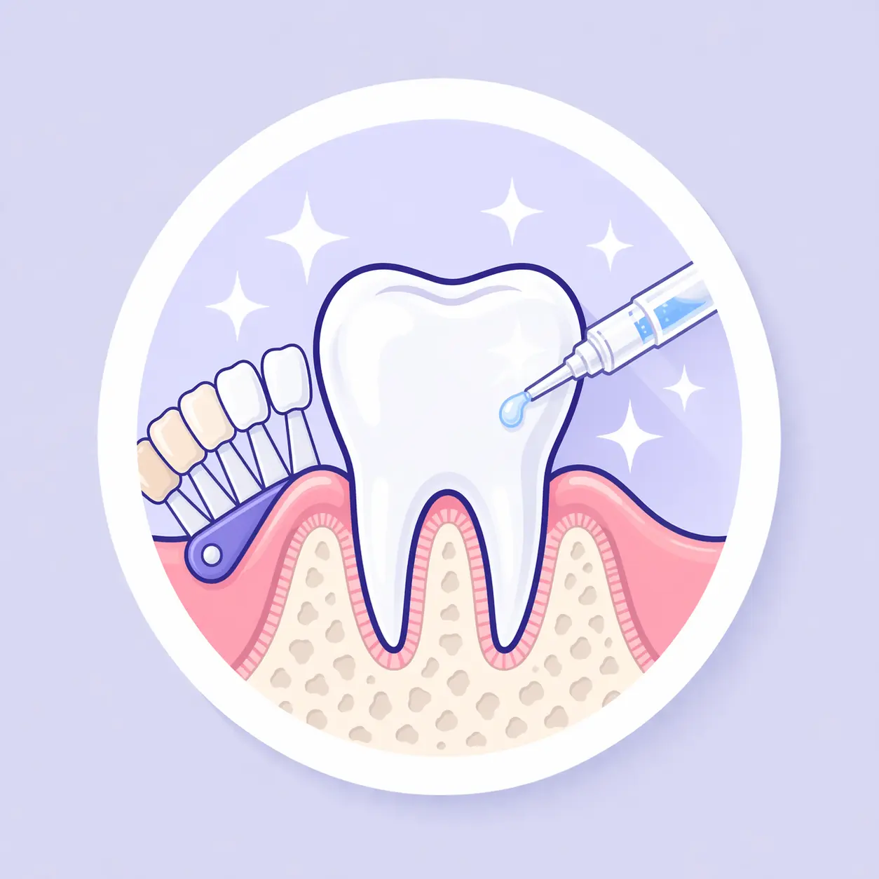 Illustrazione raffigurante il concetto di sbiancamento dentale